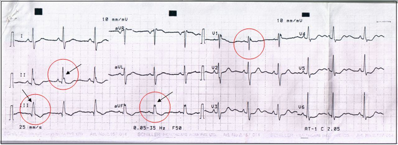 Pasted image 20260410203356.png